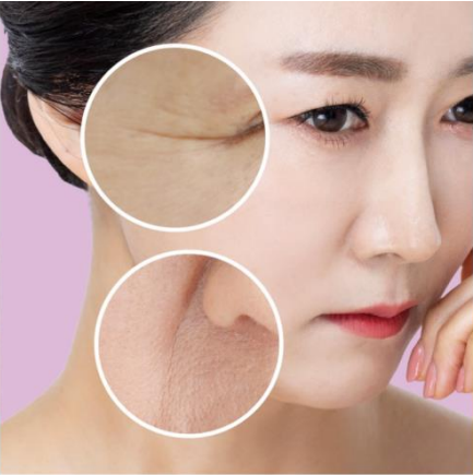 지디토닝