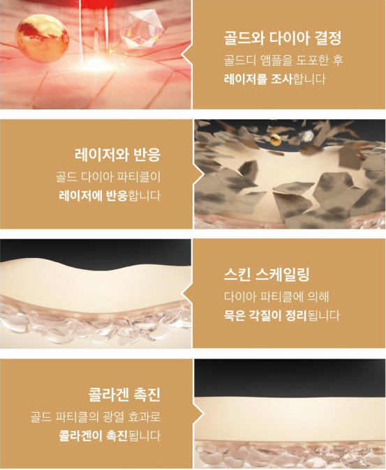 지디토닝