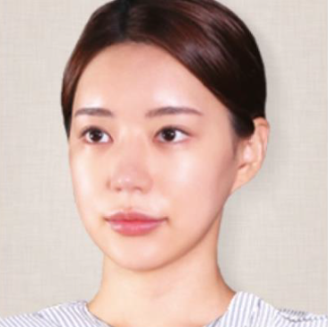 지디토닝